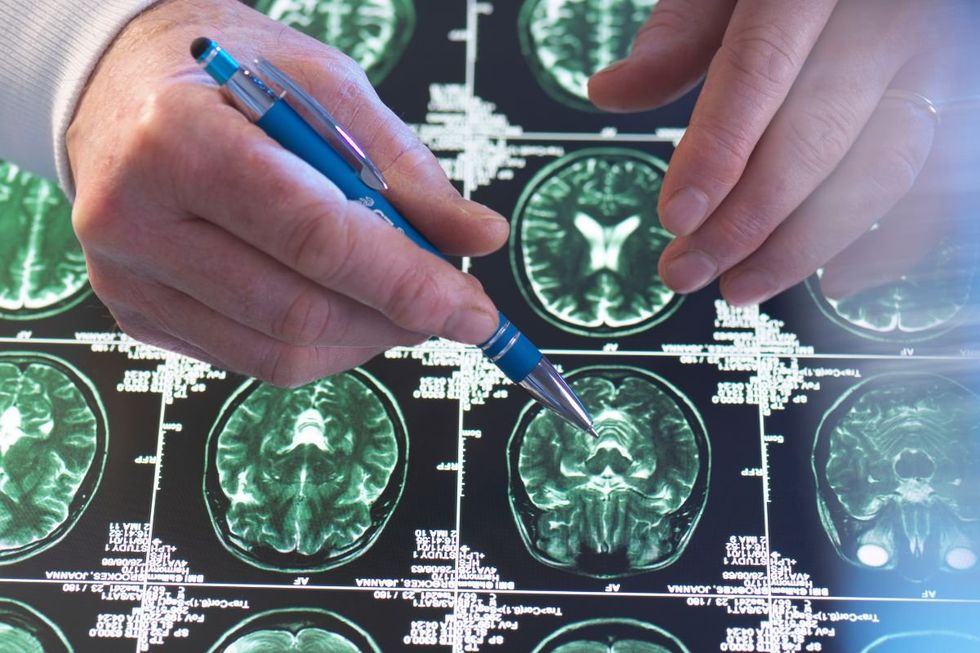 brain scan