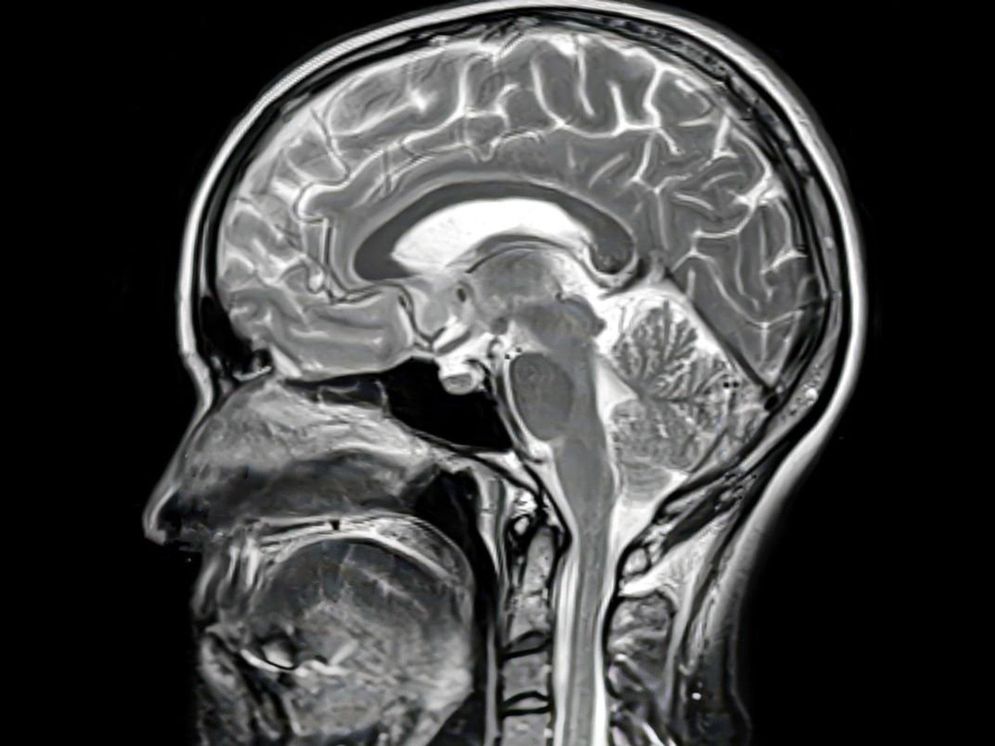 BRAIN SCAN
