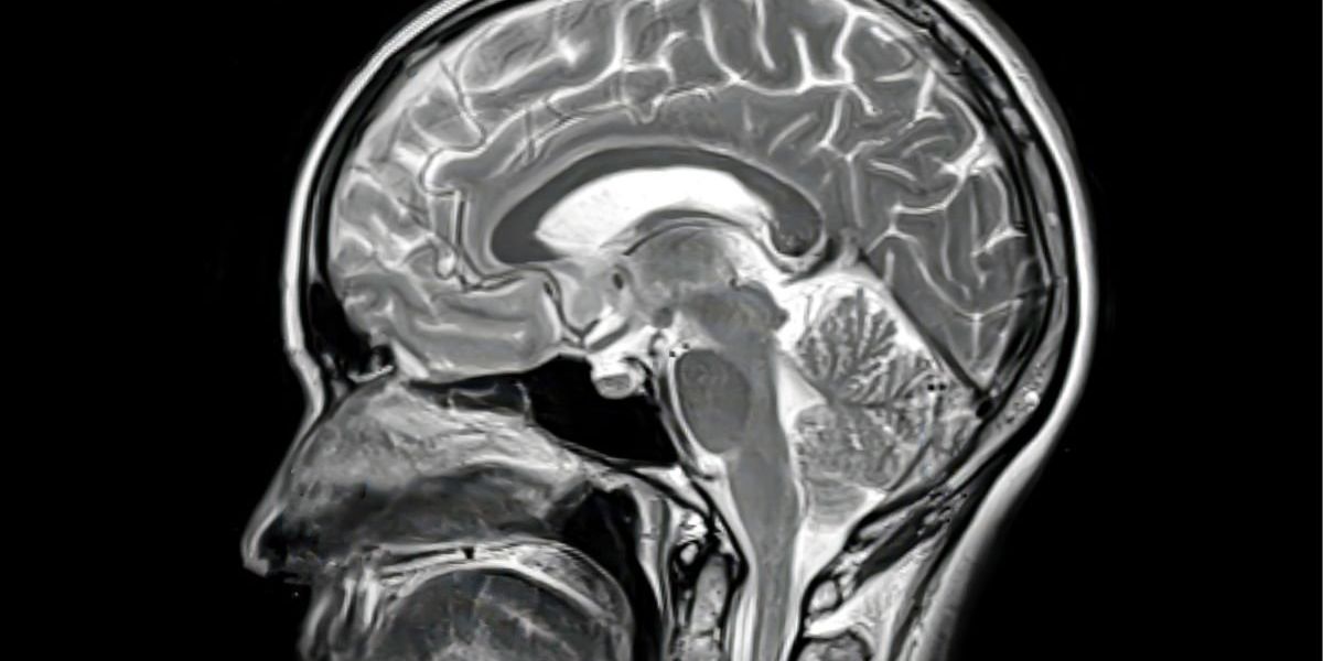 Groundbreaking blood test could identify women at risk of dementia ‘decades before’ symptoms emerge Groundbreaking blood test could identify women at risk of dementia ‘decades before’ symptoms emerge