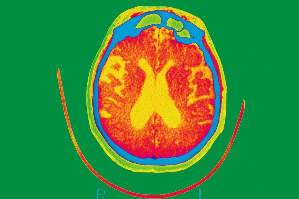 BRAIN SCAN