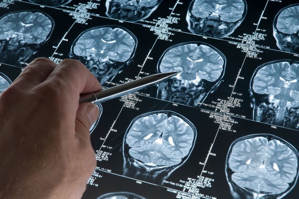 BRAIN SCAN