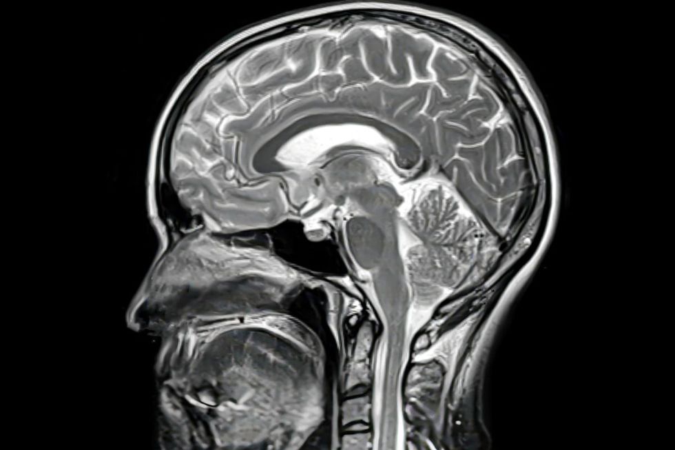 BRAIN SCAN