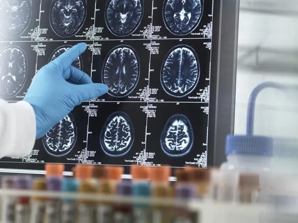 Brain scan