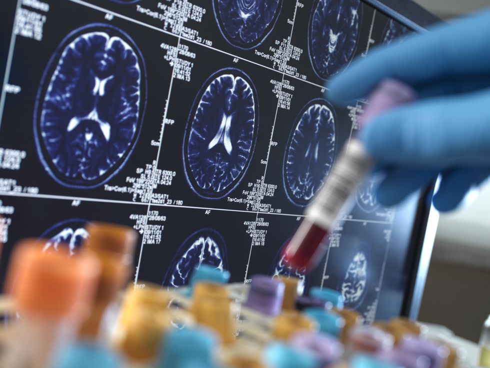 Brain scans (Stock)