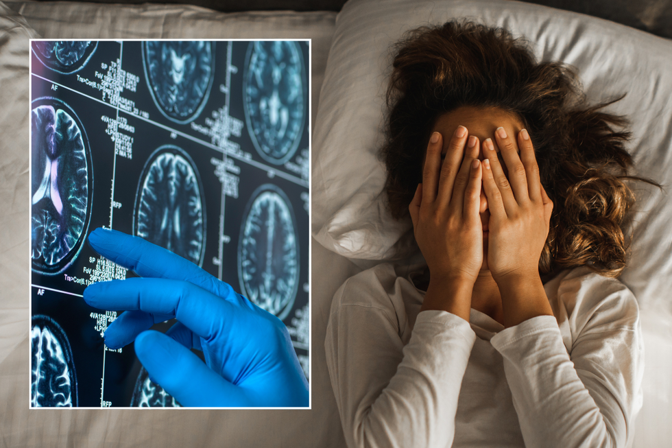Brain scans; woman struggling to sleep