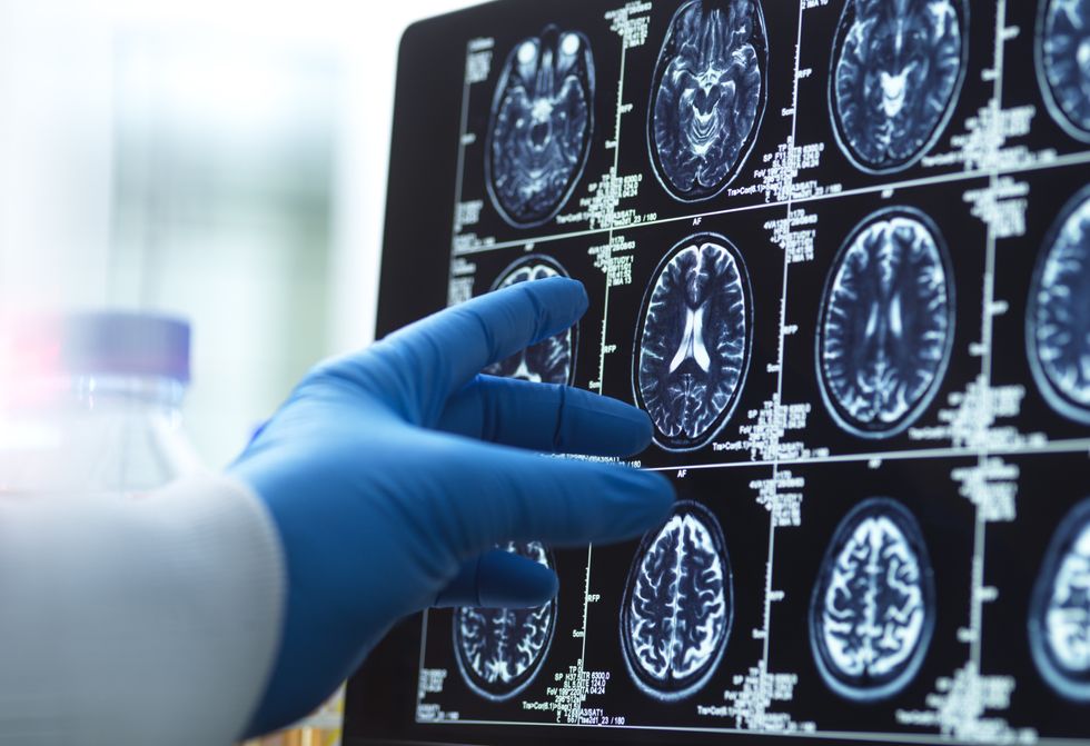 Brain scans