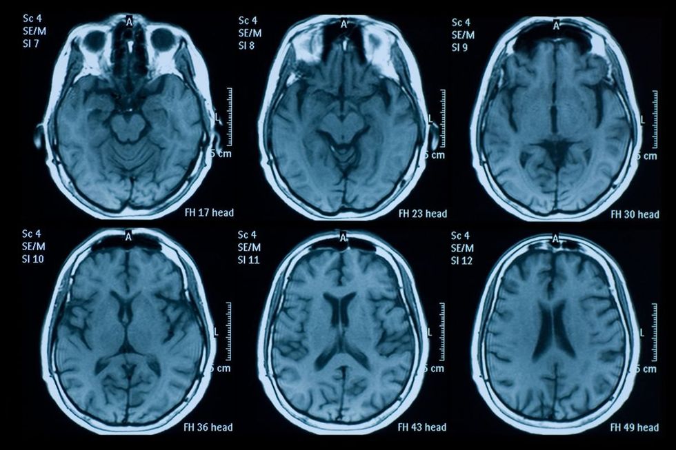 brain scans