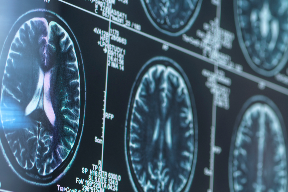 Brain scans