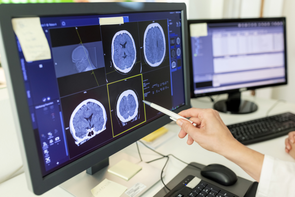 Brain scans