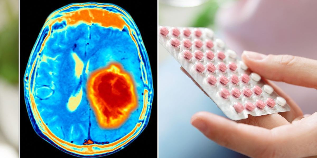 NextImg:Pill taken by more than 3 million women in Britain linked to elevated brain tumour risk