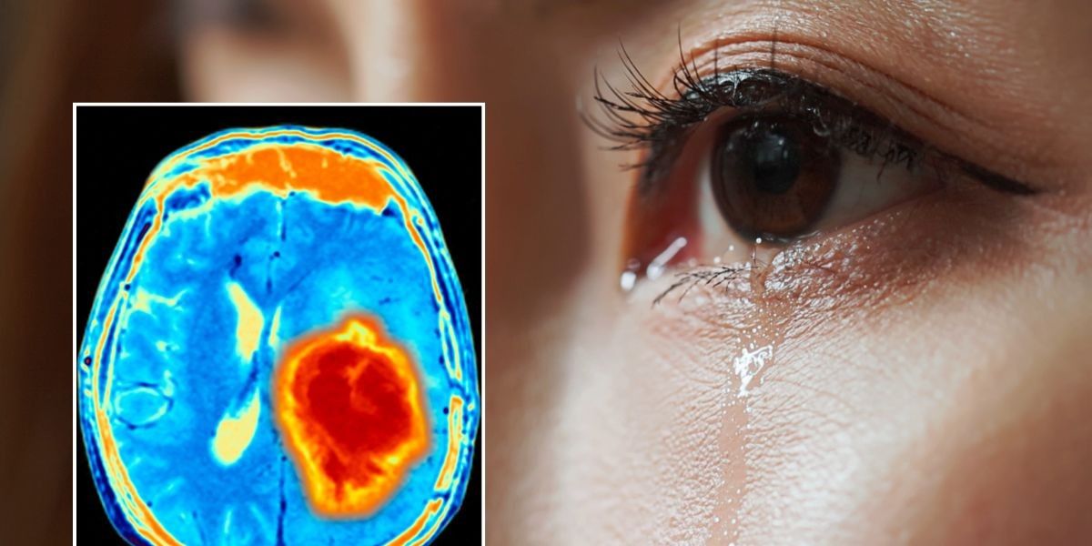 NextImg:Quick GP tear test could transform early detection of brain tumours with 'high accuracy'
