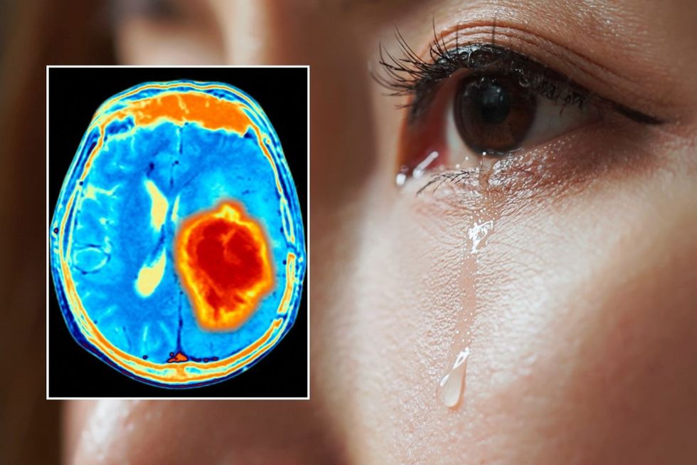 BRAIN TUMOUR