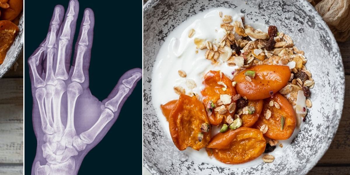 The two nutrients spine surgeons say are ‘most important’ for lifelong bone health The two nutrients spine surgeons say are ‘most important’ for lifelong bone health