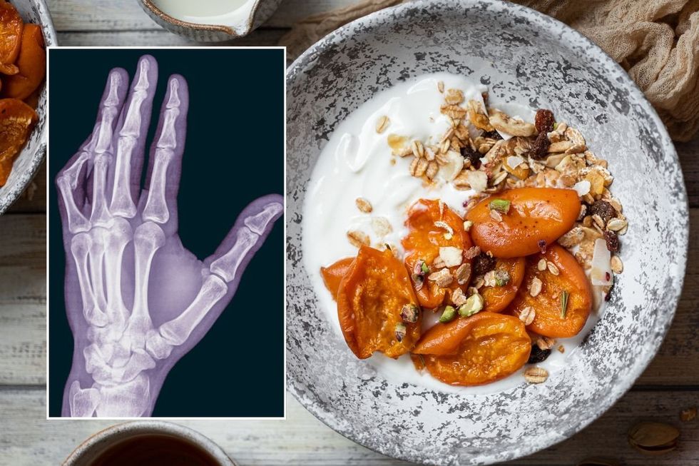 Breakfast bowl and scan of hand bones