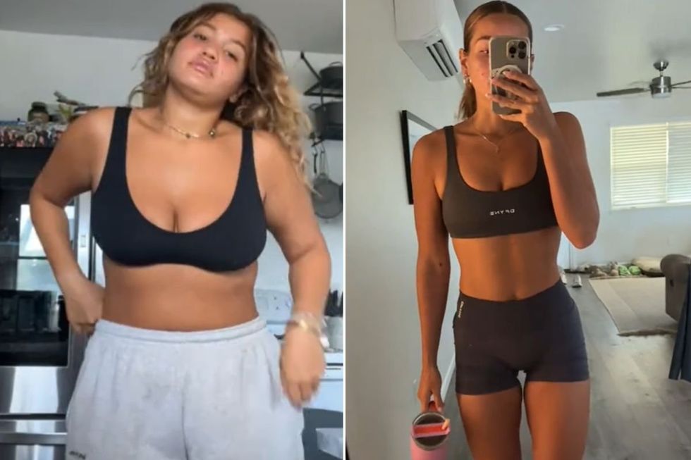 brooklynn before and after