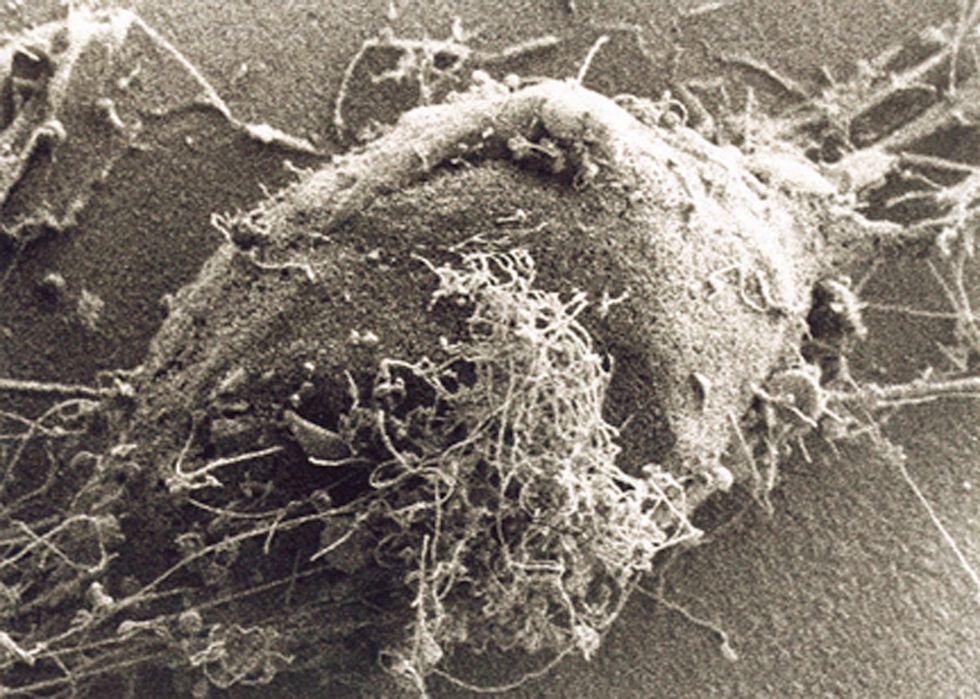 Bundibugyo ebolavirus