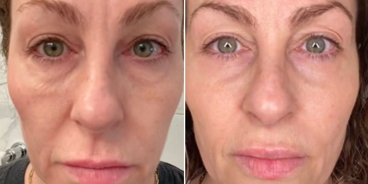 51-year-old swears by skin care product for tackling wrinkles 51-year-old swears by skin care product for tackling wrinkles