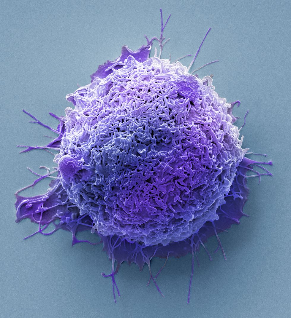 Cancer cell