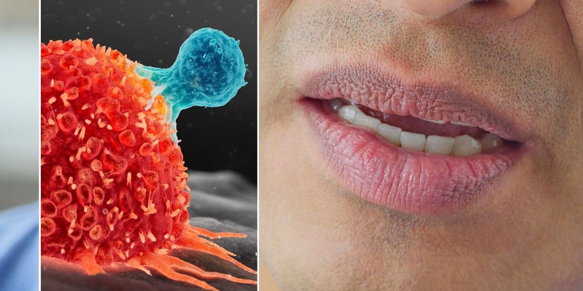 NextImg:Cancer doctor warns never to ignore 'really common' mouth symptom lasting three weeks
