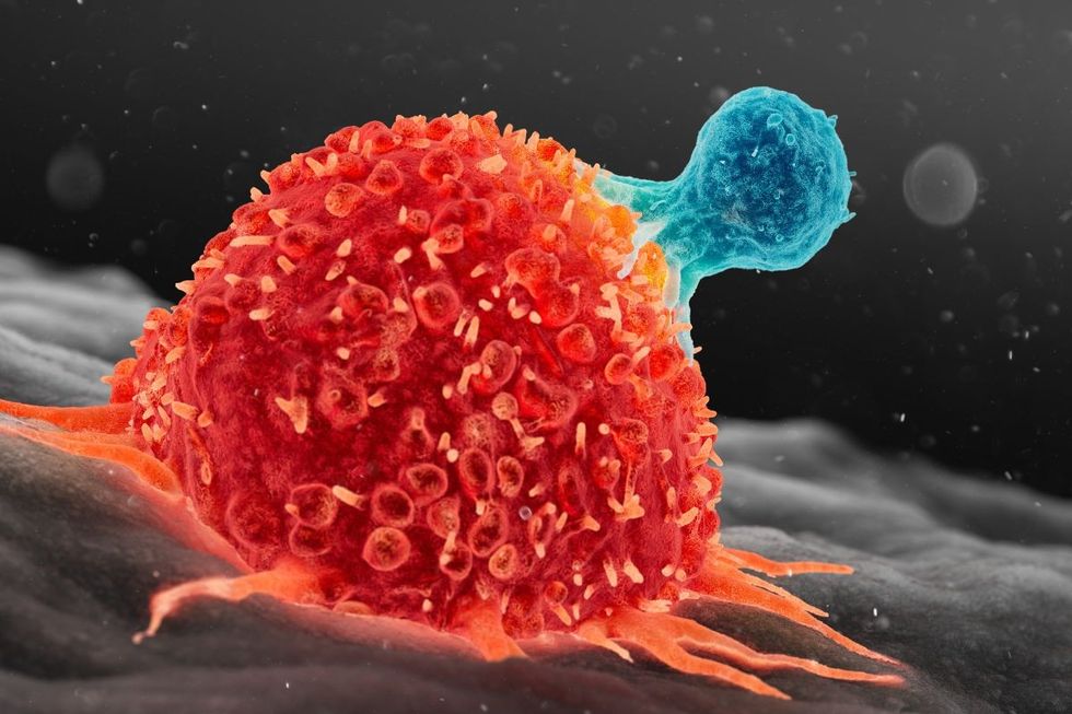 CANCER COMPOSITE