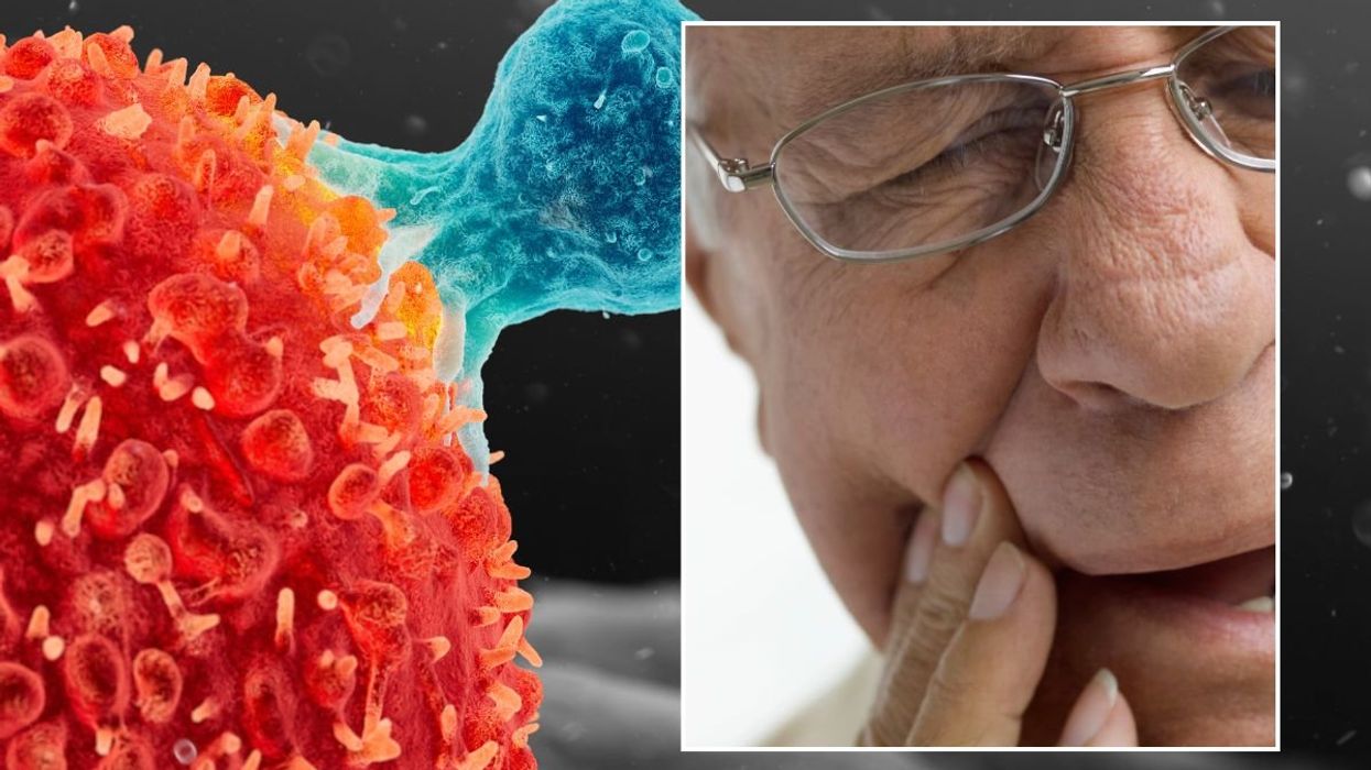 CANCER ILLUSTRATION AND MOUTH PAIN