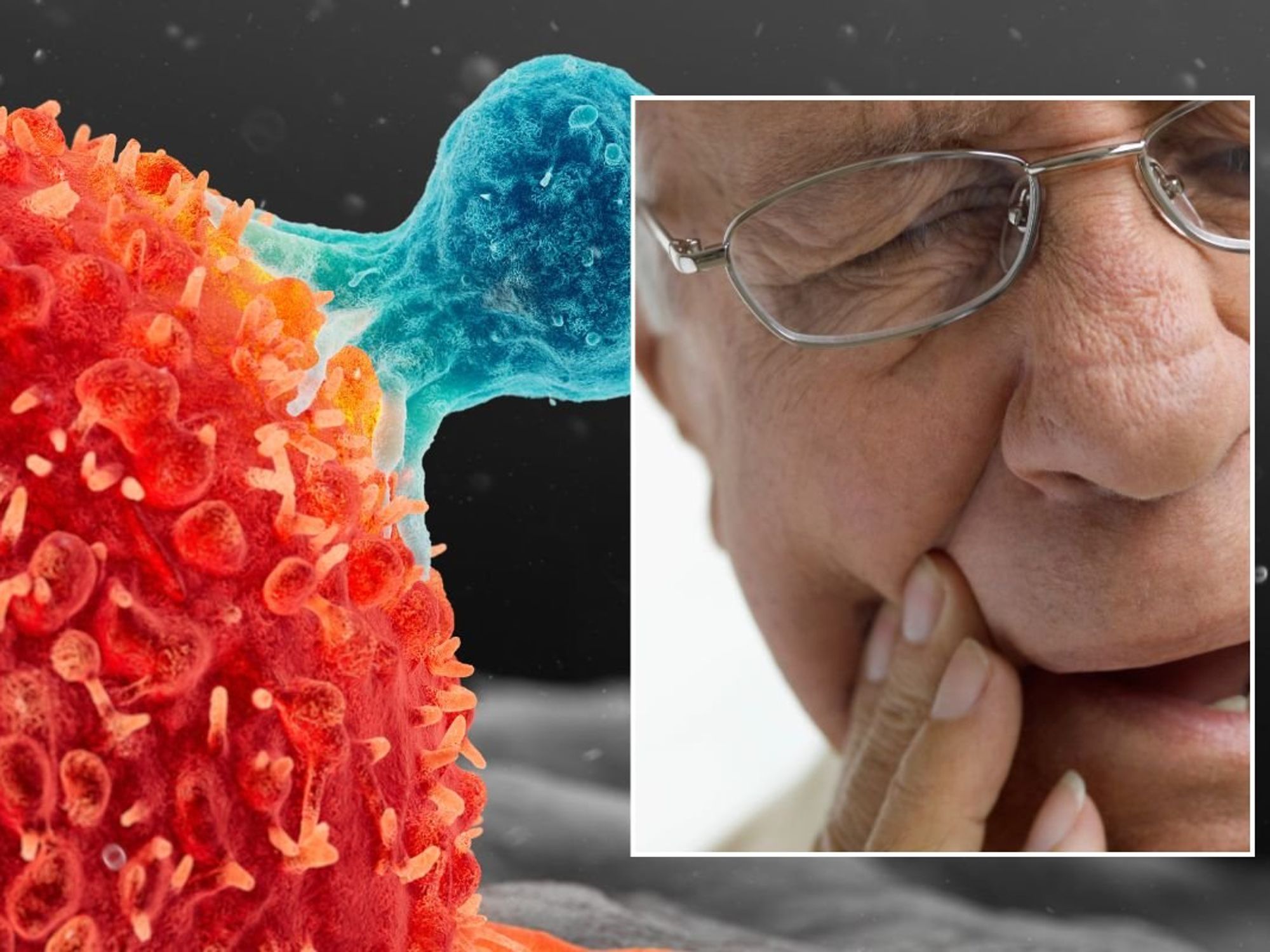 CANCER ILLUSTRATION AND MOUTH PAIN