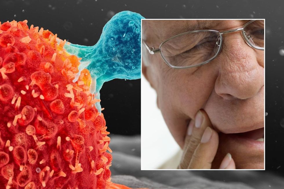 CANCER ILLUSTRATION AND MOUTH PAIN