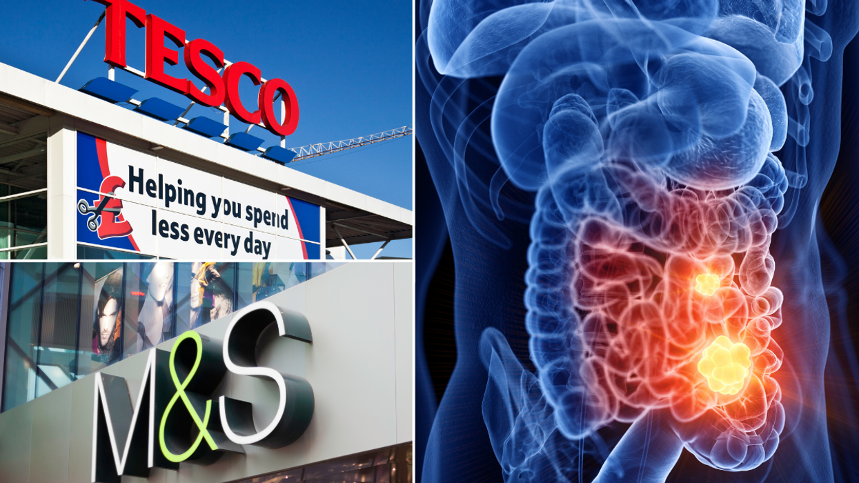 Cancer illustration body; Marks & Spencer store; Tesco store