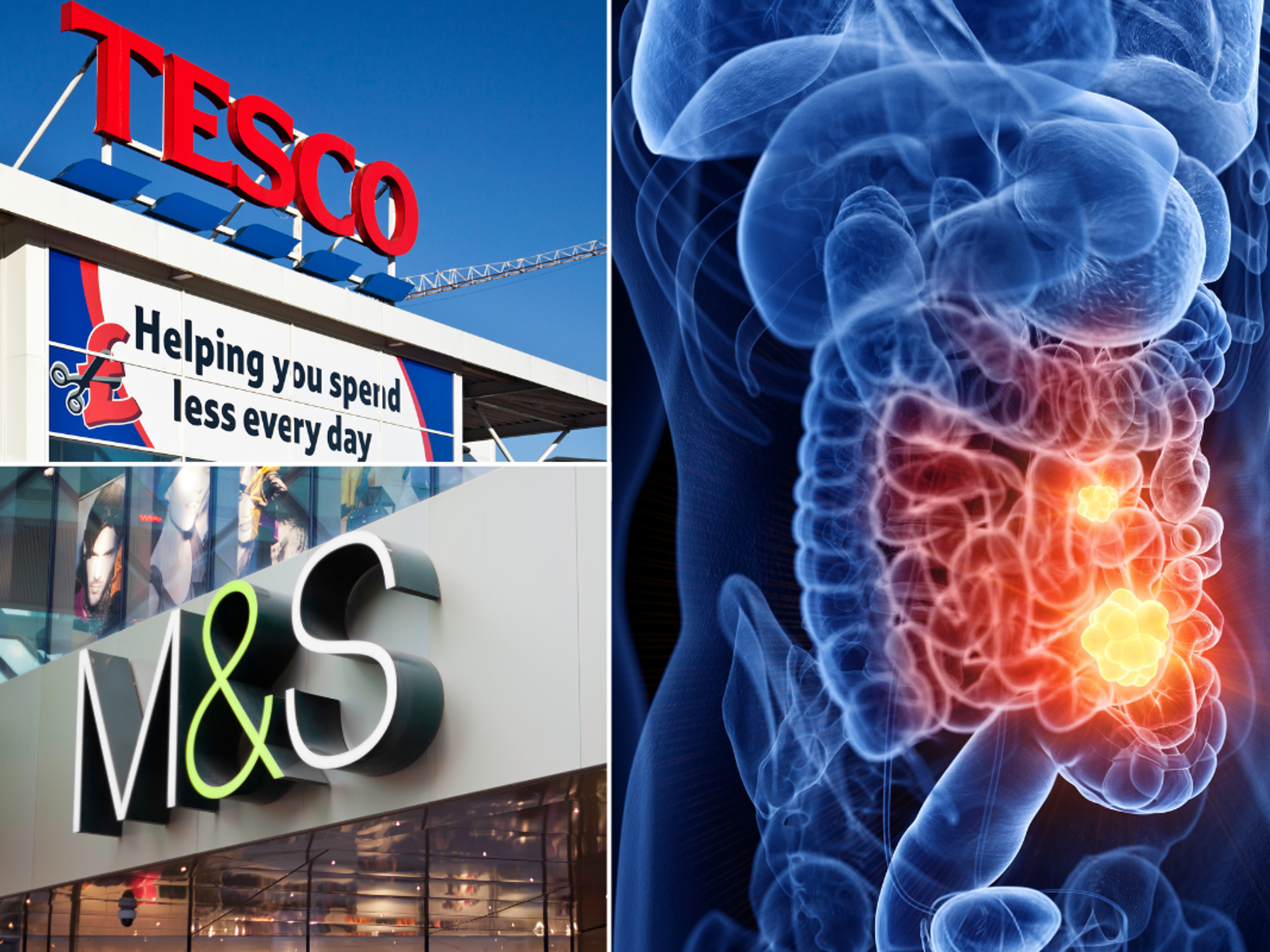 Cancer illustration body; Marks & Spencer store; Tesco store