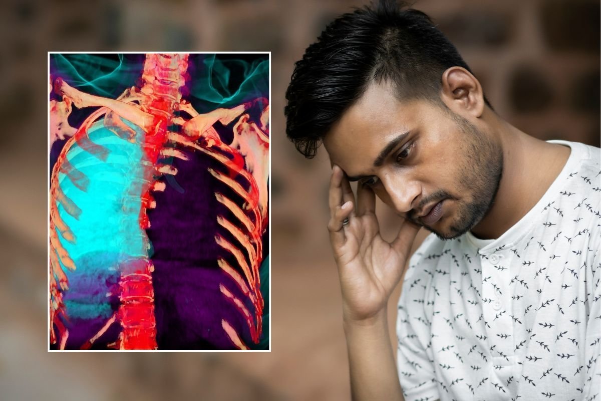 CANCER PATIENT AND 3D IMAGING OF LUNG CANCER