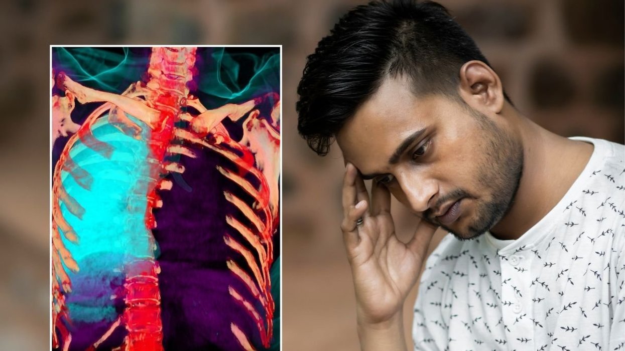 CANCER PATIENT AND 3D IMAGING OF LUNG CANCER