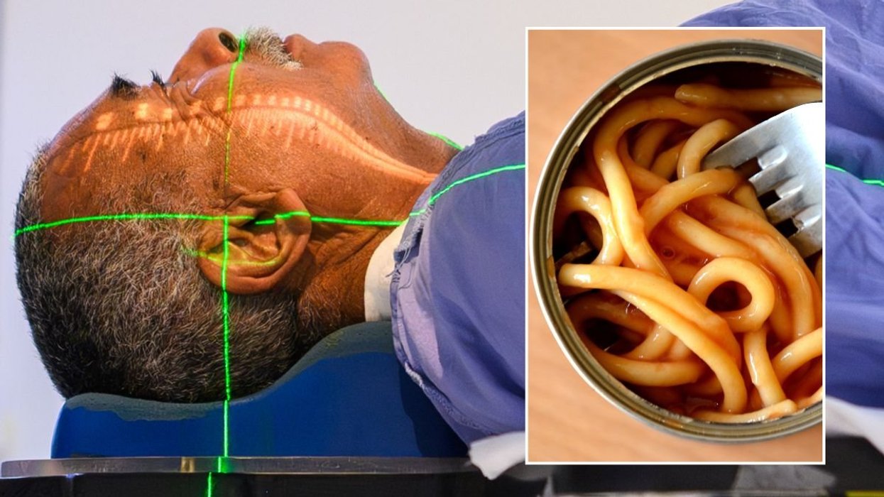 CANCER PATIENT UNDERGOING SCAN