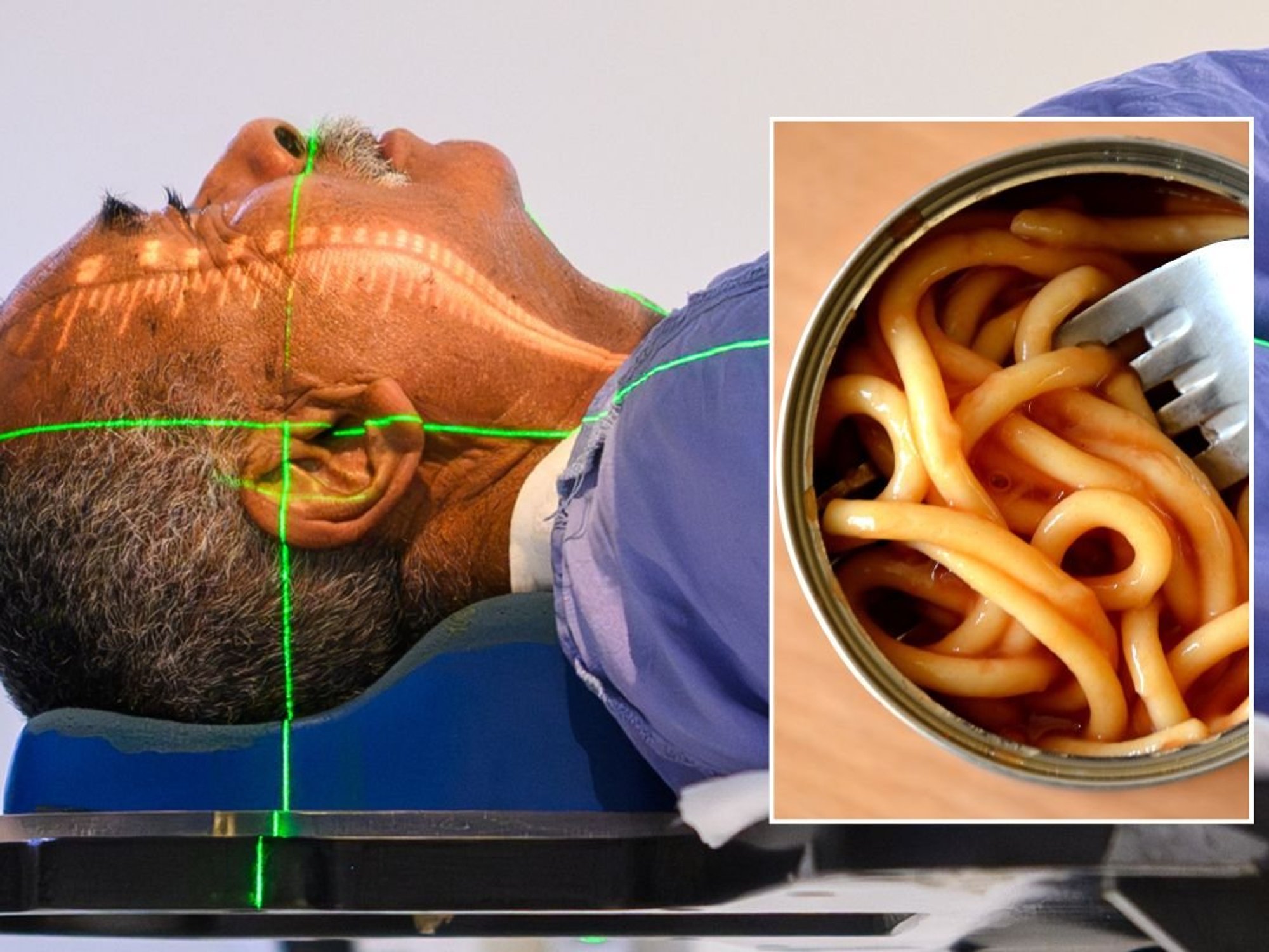 CANCER PATIENT UNDERGOING SCAN