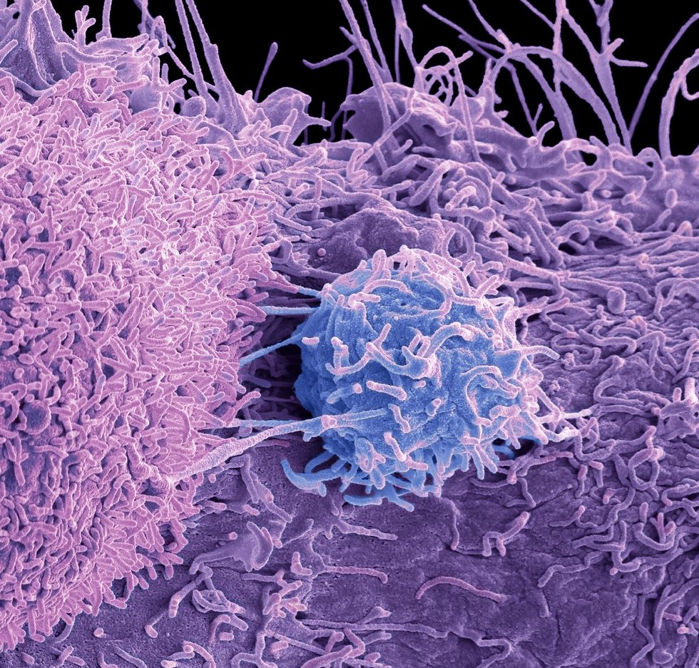 Cancer scan