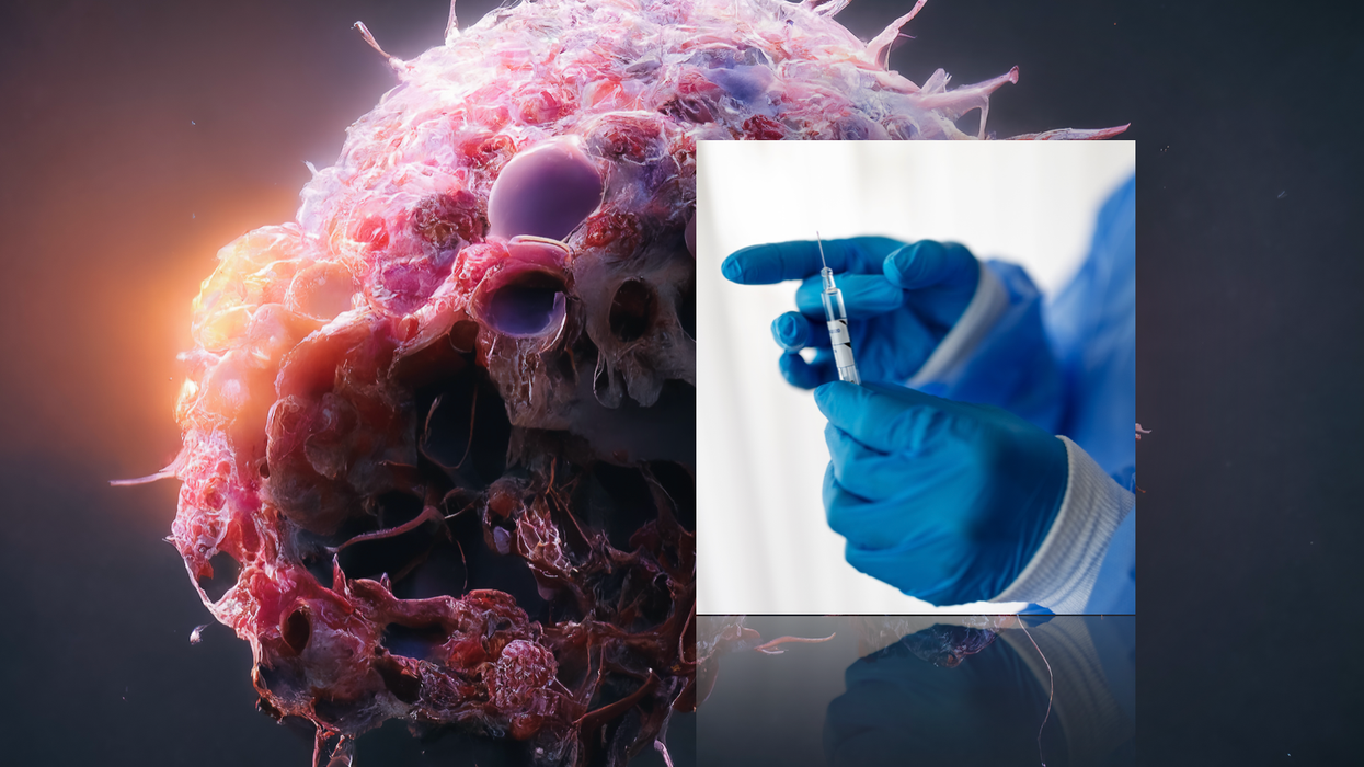 Cancer tumour (left) and vaccine (right)