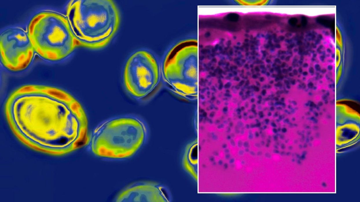 Candida auris under miscroscope