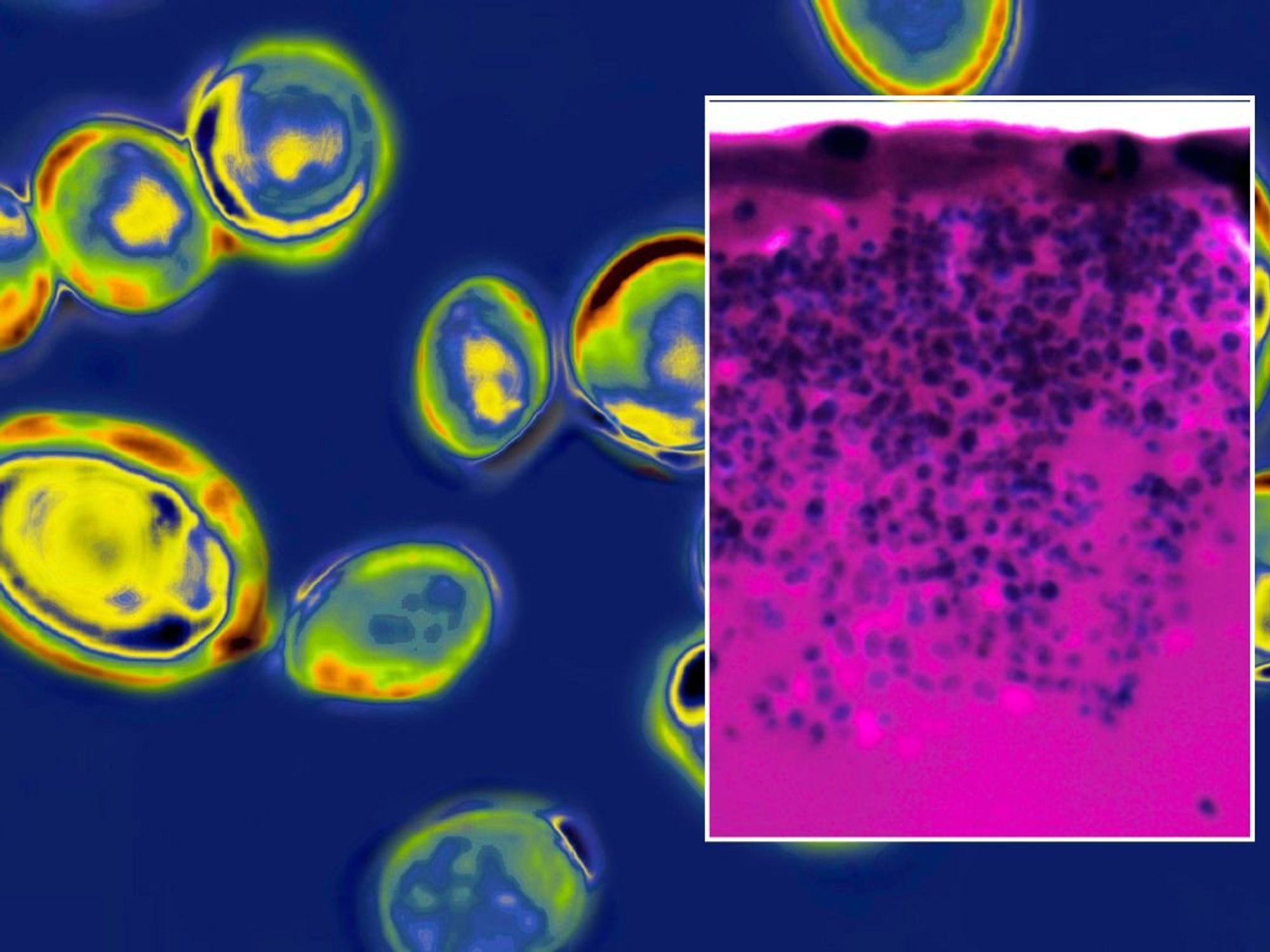 Candida auris under miscroscope