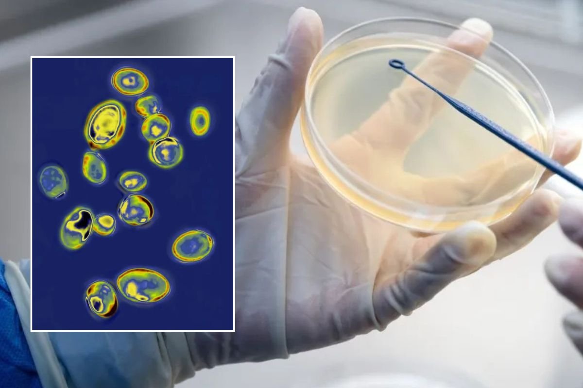 CANDIDA AURIS