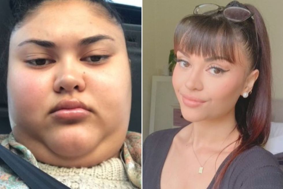 Carla before and after