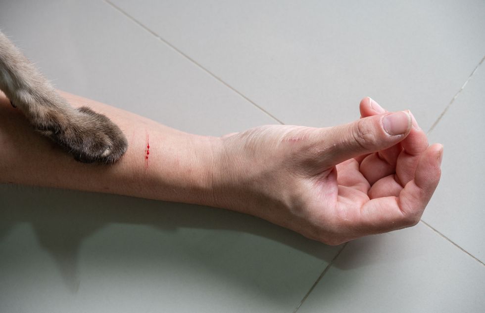 CAT SCRATCH ON ARM