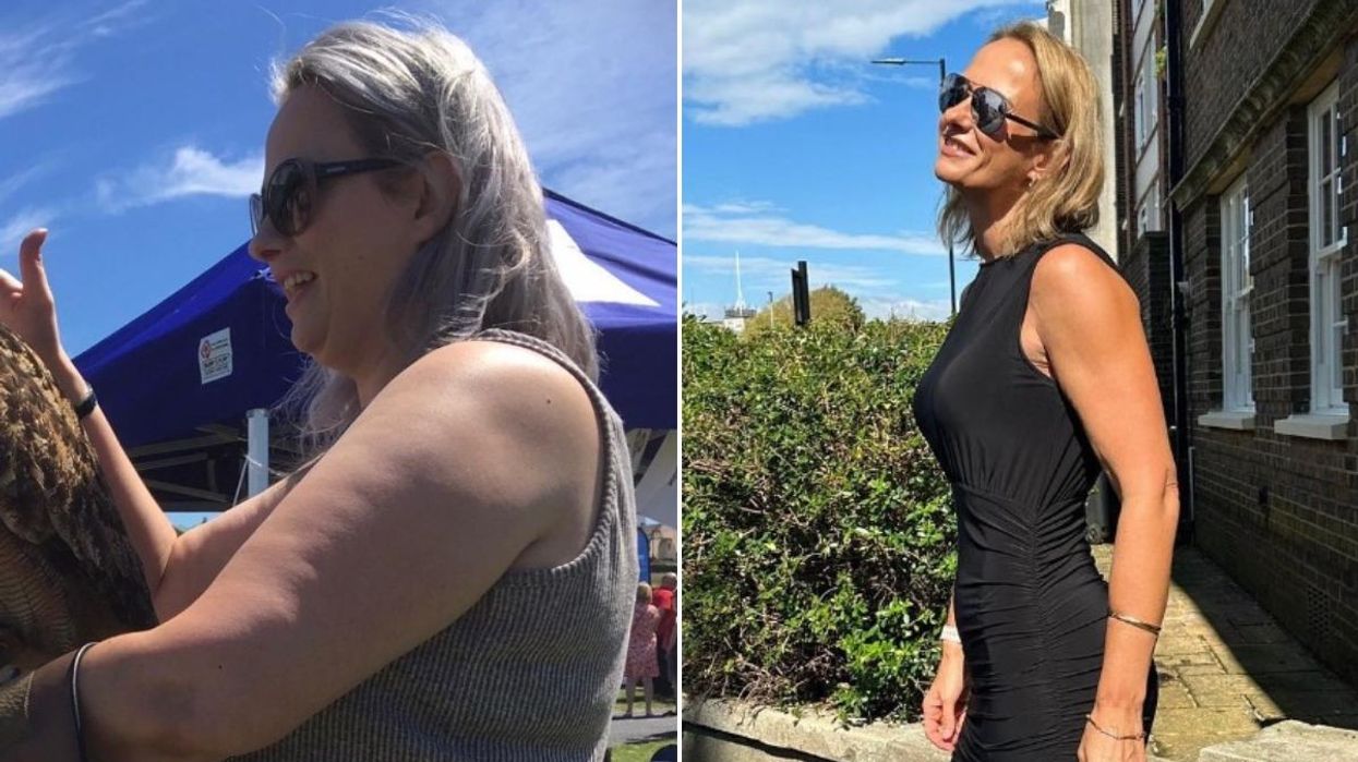Cheeks before and after weight loss