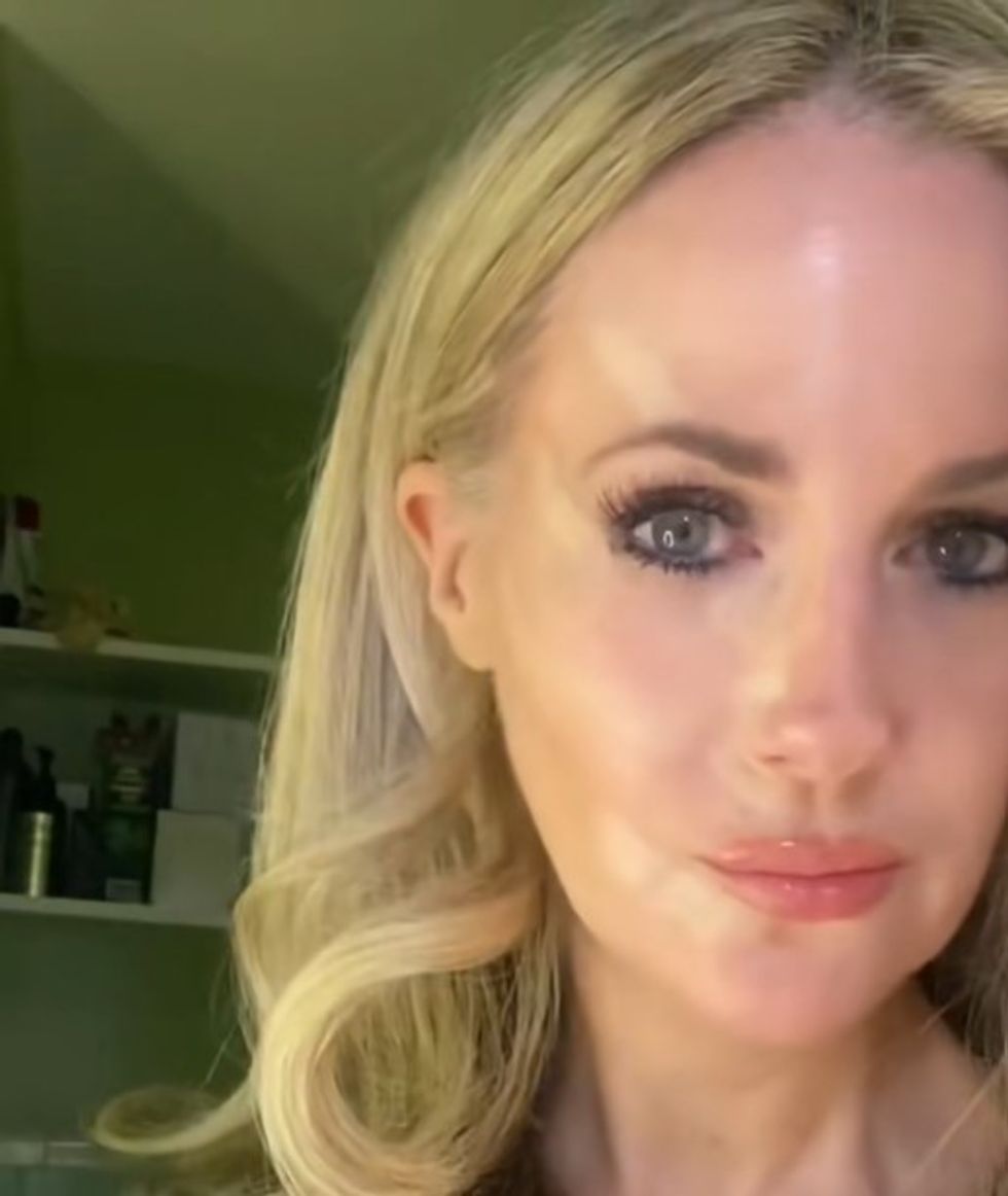 Chele demonstrating concealer application