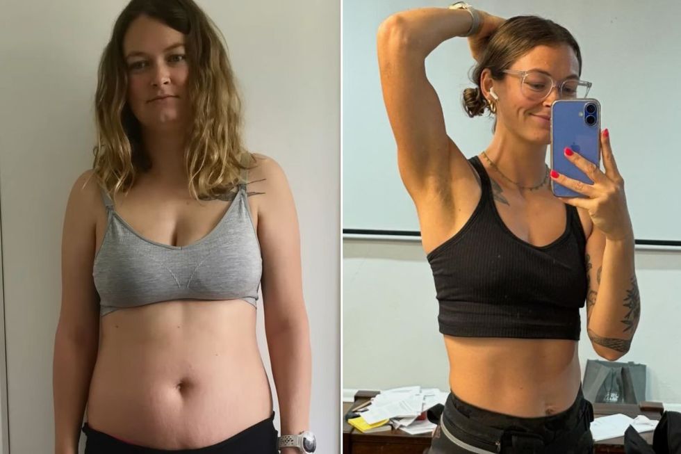 Chelsea Mae before and after
