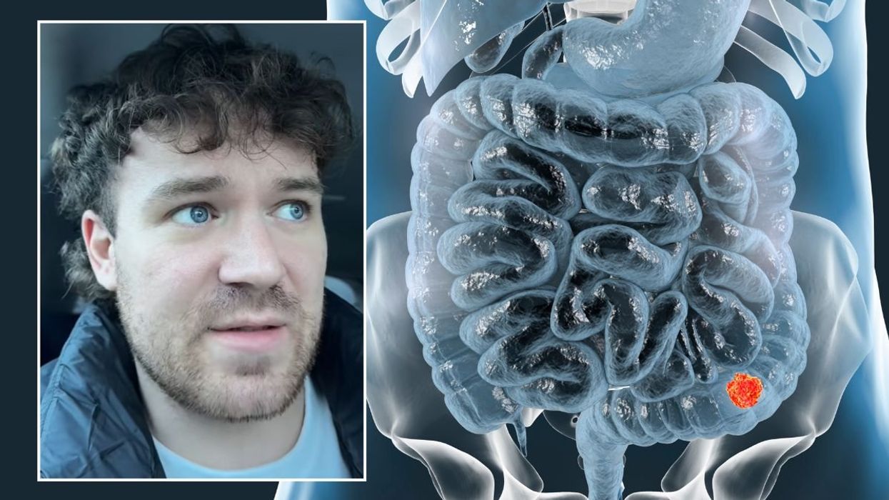 Chris headshot and bowel illustration