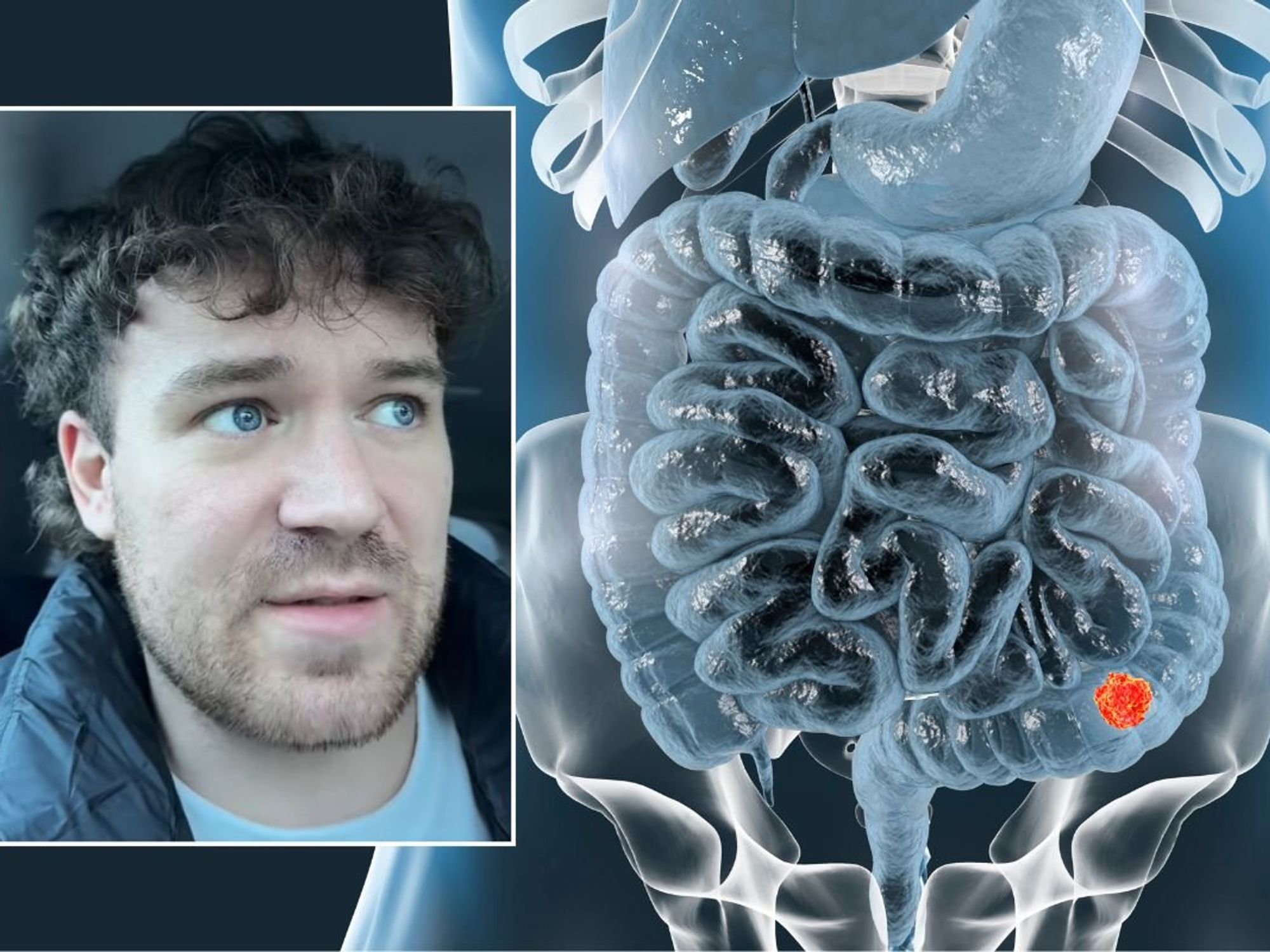 Chris headshot and bowel illustration