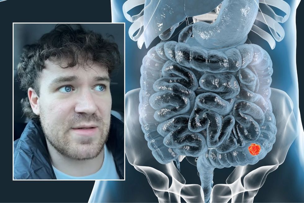 Chris headshot and bowel illustration