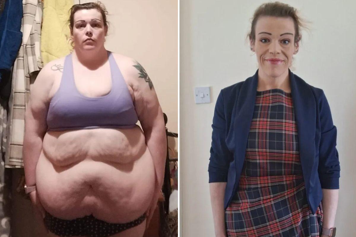 Christina before and after