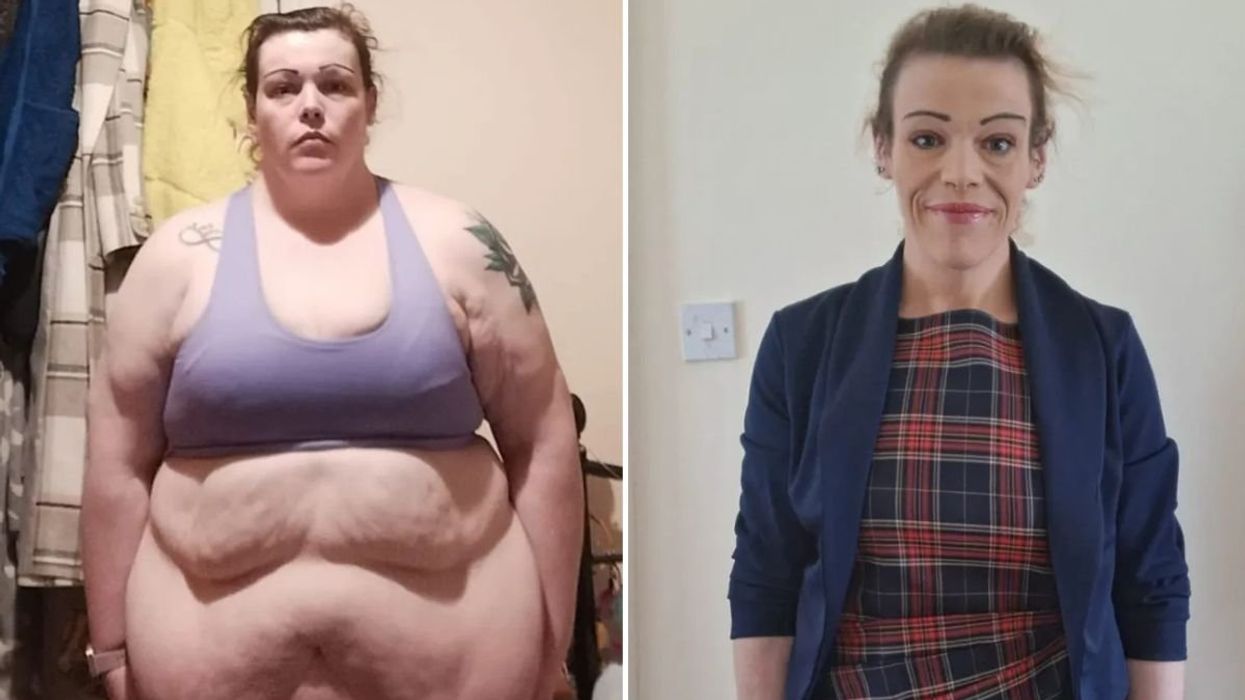 Christina before and after