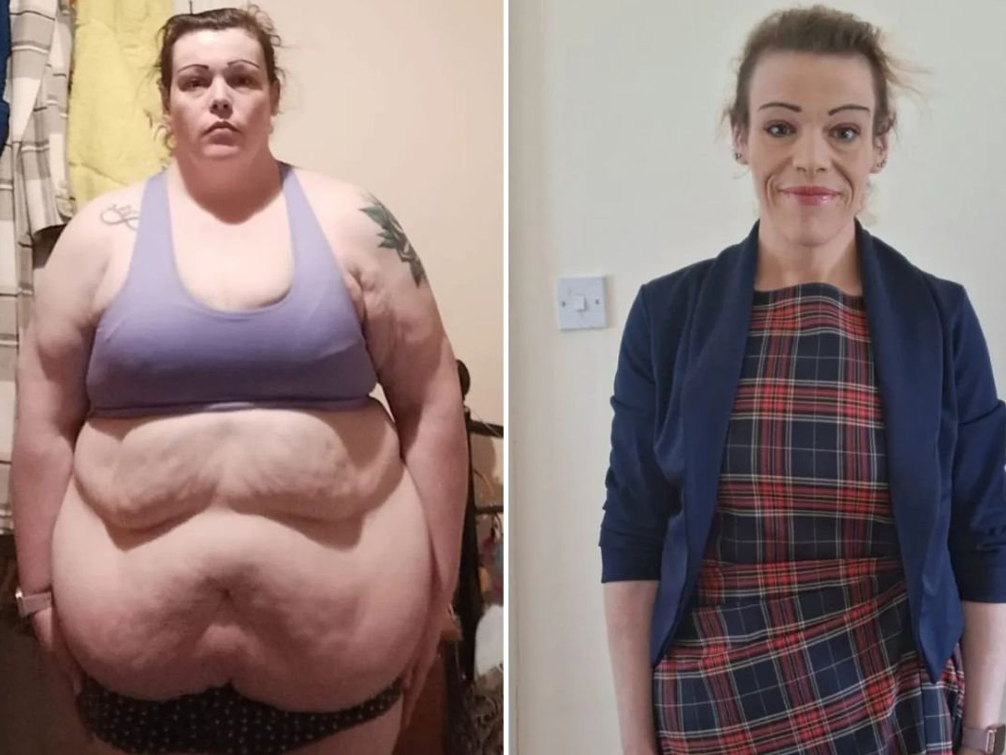 Christina before and after