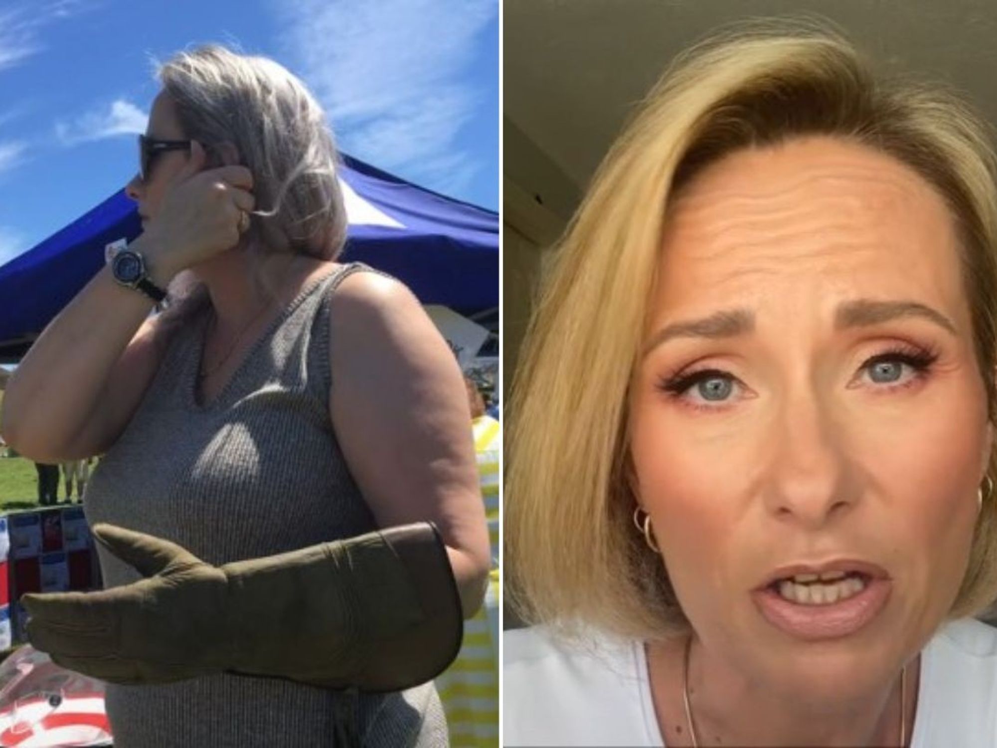 Claire before and after